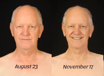 Roger-Before-After-Face-800